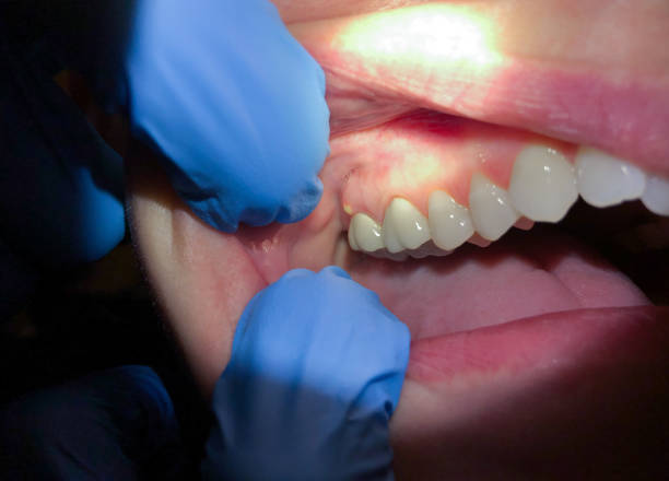 Best Emergency Cosmetic Dentistry (e.g., broken veneers) in Trenton, MO